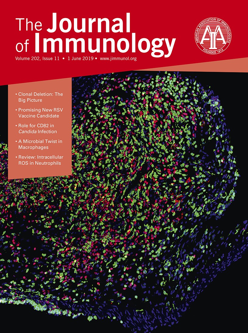 Strain Specific Manifestation Of Lupus Like Systemic Autoimmunity Caused By Zap70 Mutation Autoimmunity Lasid Latin American Society For Immunodeficiencies